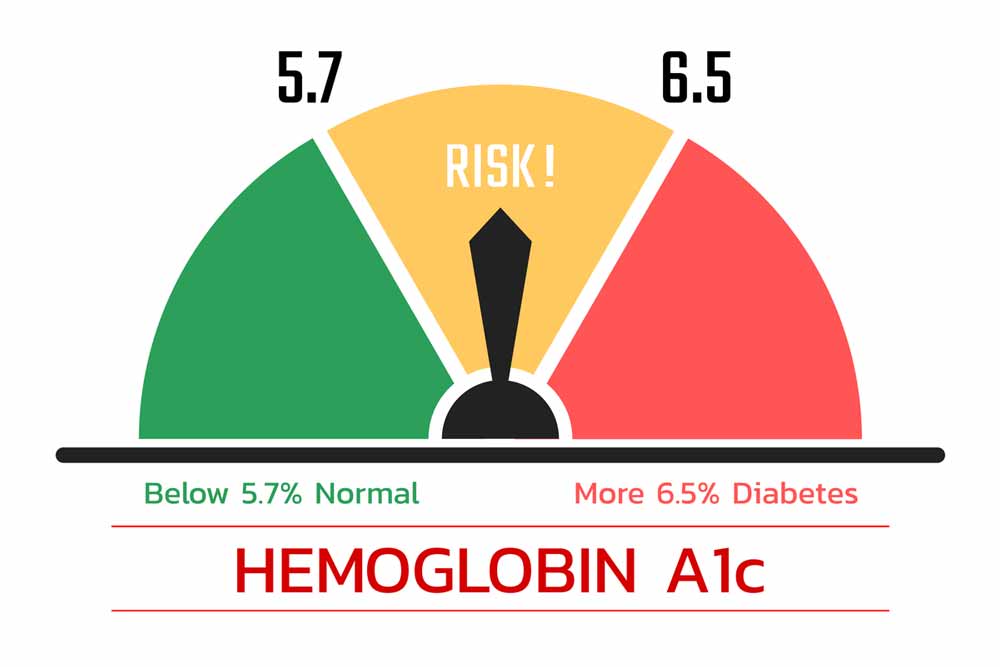 HBA1C Chart