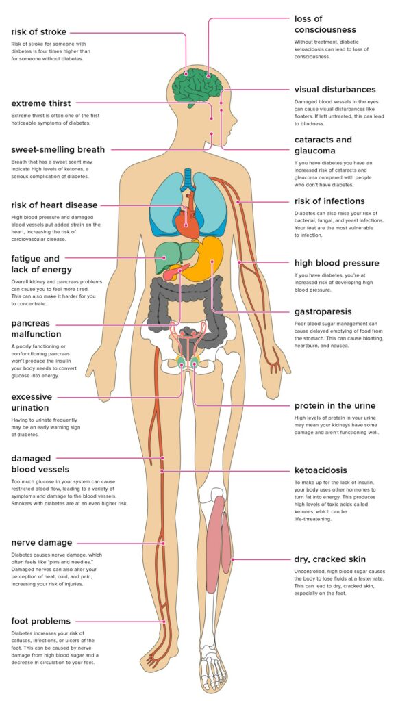 body parts that give high sign of sugar