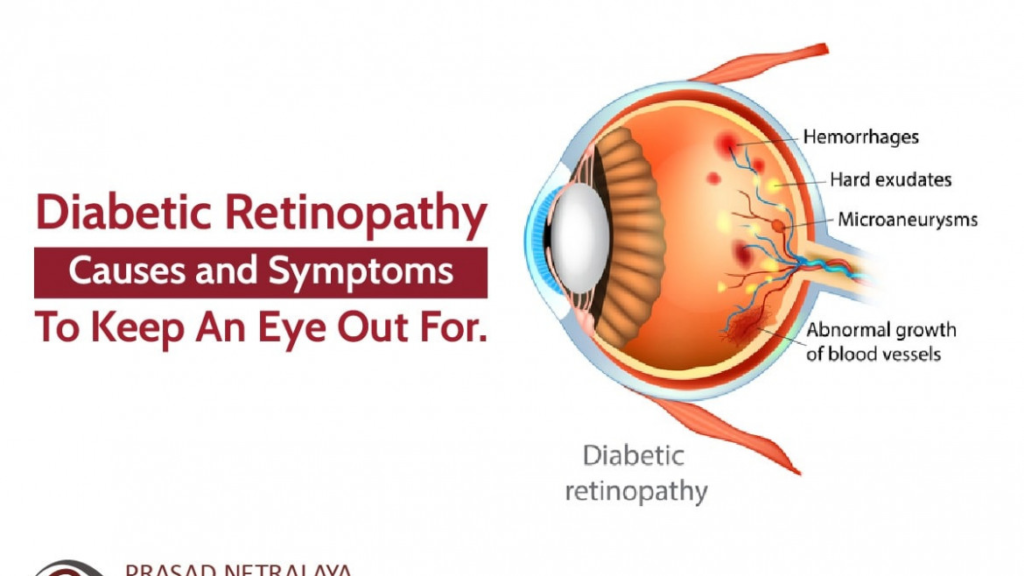 diabetic retinopathy cause and symptoms