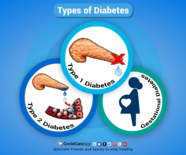 other types of diabetes