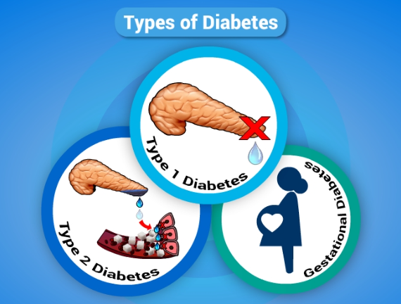 Other Types of Diabetes