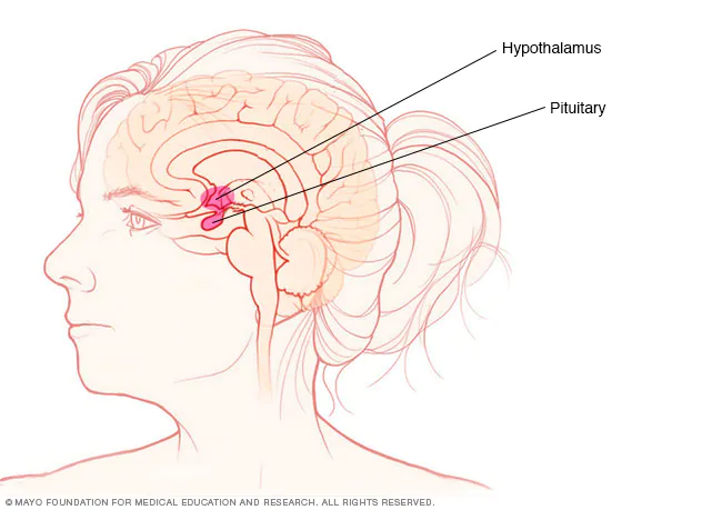 Diabetes Insipidus Symptoms & Causes